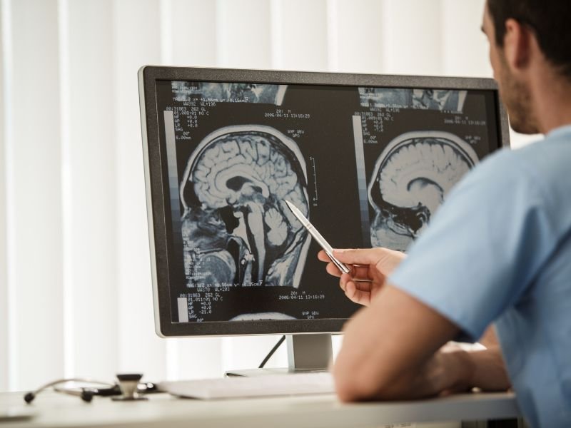 Cirurgia Minimamente Invasiva de Coluna em Tubarão, SC