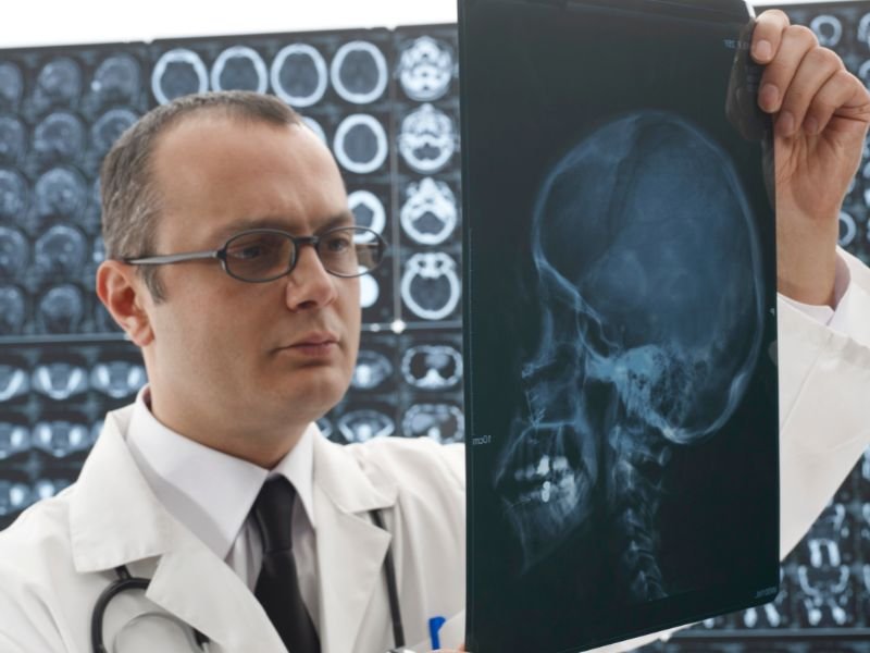 Cirurgia de Tumor de Hipófise em Criciúma