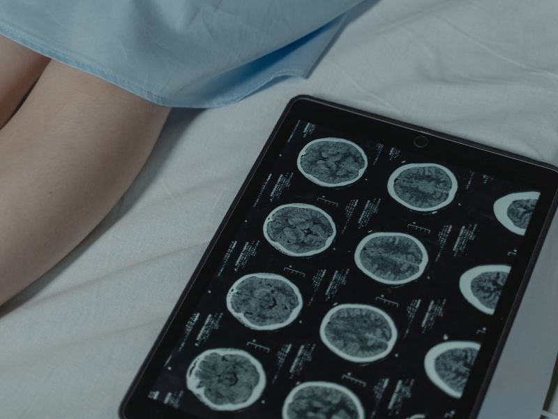 Cirurgia de hérnia de disco em Tubarão, SC