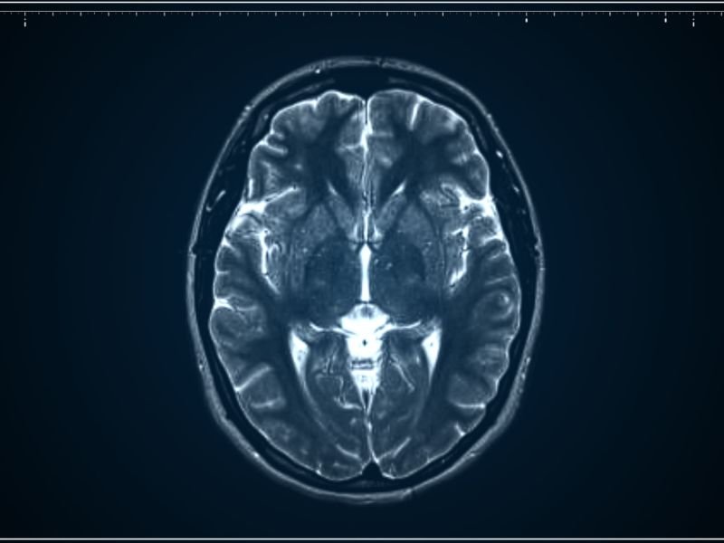 Médico neurocirurgião em Tubarão, SC