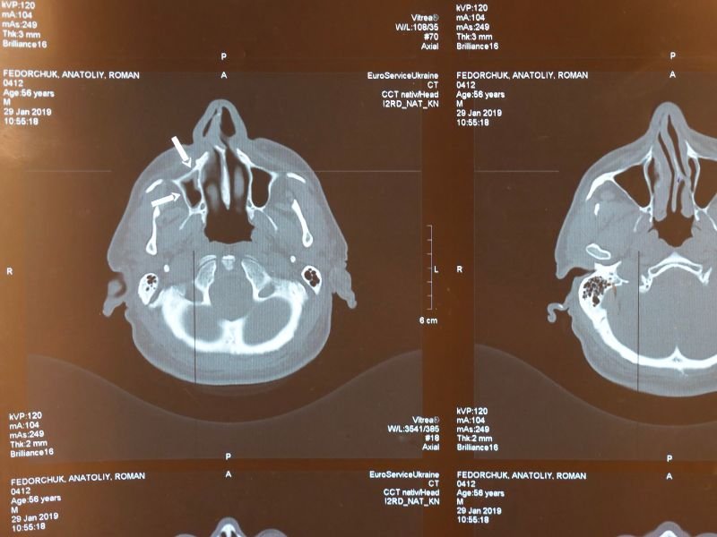 Clínica Especializada em Cefaleia em Criciúma